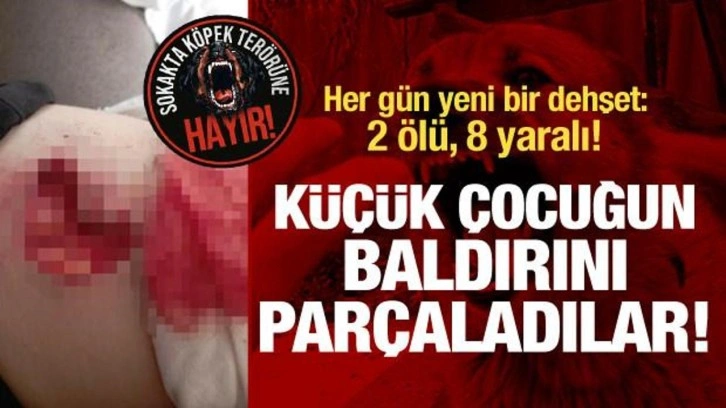 Başıboş köpekler çocuğun bacağını parçaladı! Her gün yeni bir dehşet: 2 ölü 8 yaralı!