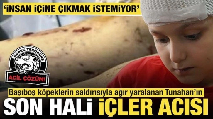 Başıboş köpeklerin saldırısıyla ağır yaralanan Tunahan’ın son hali içler acısı