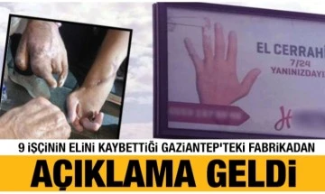 9 işçinin elini kaybettiği Gaziantep’teki fabrikadan açıklama geldi