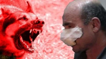 Namaza giderken köpek saldırısına uğradı